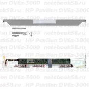 Матрица для ноутбука HP Pavilion DV6z-3000 (1366x768 HD) TN, 40pin, Матовая